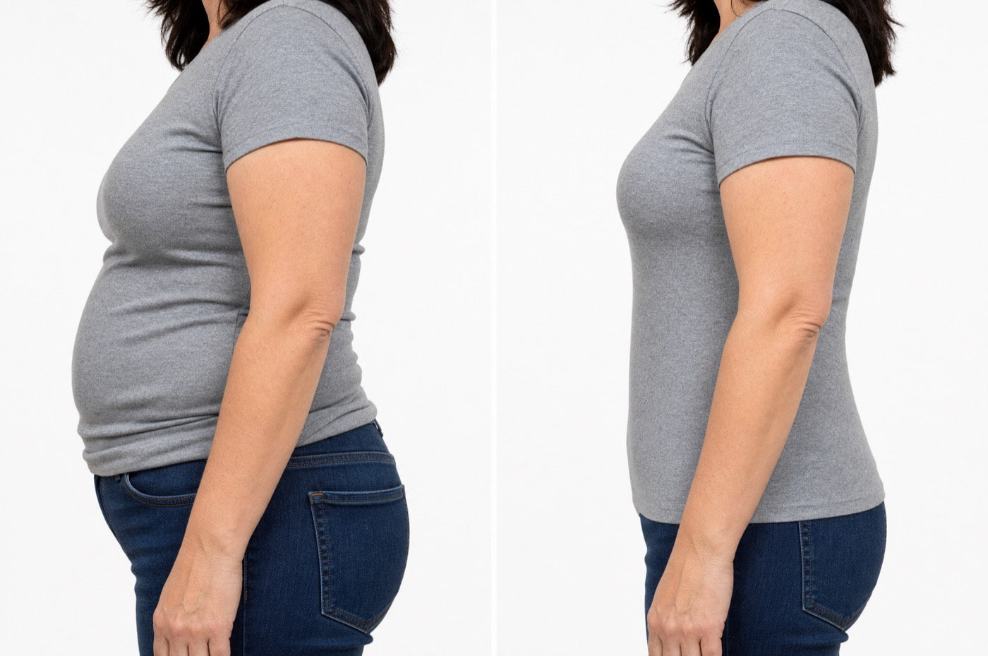 Before and after, side profile